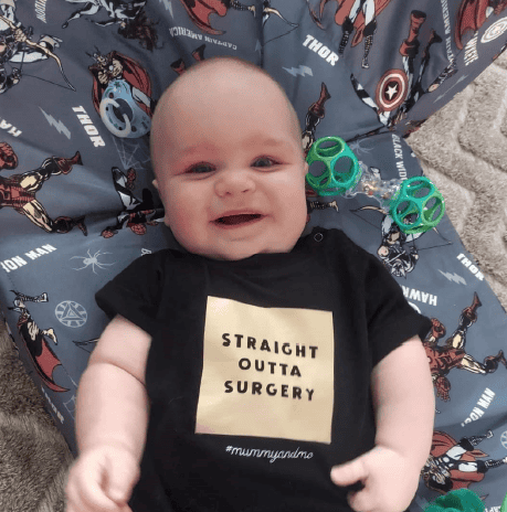 Baby boy with sagittal synostosis