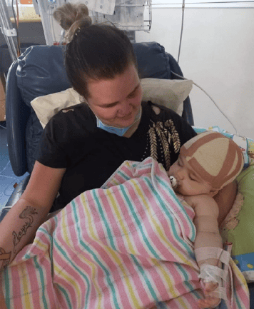 Little boy with sagittal synostosis recovering from surgery with bandage on head held by his mother