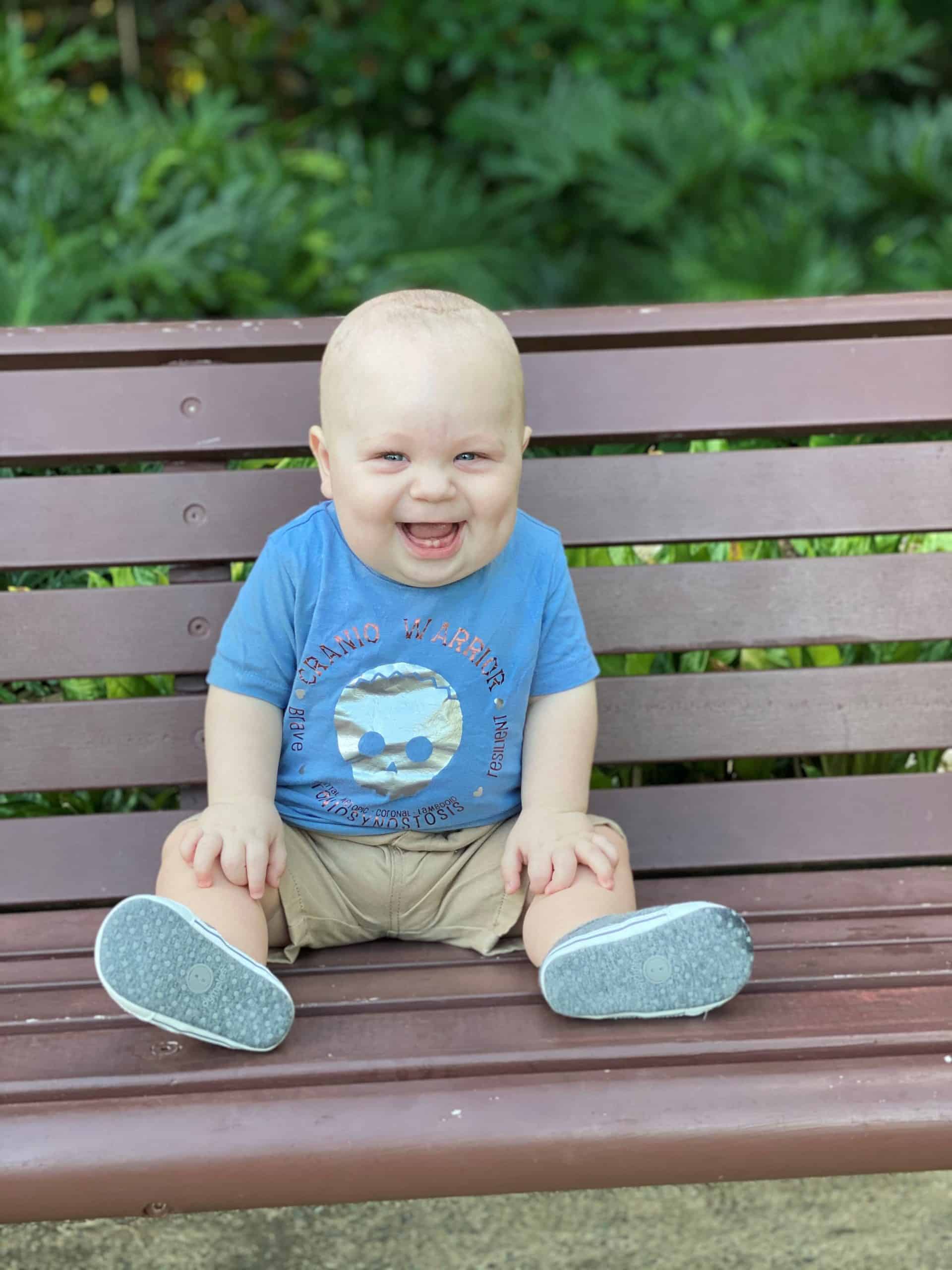 Baby with metopic synostosis and cystic fibrosis sitting on a bench outdoors