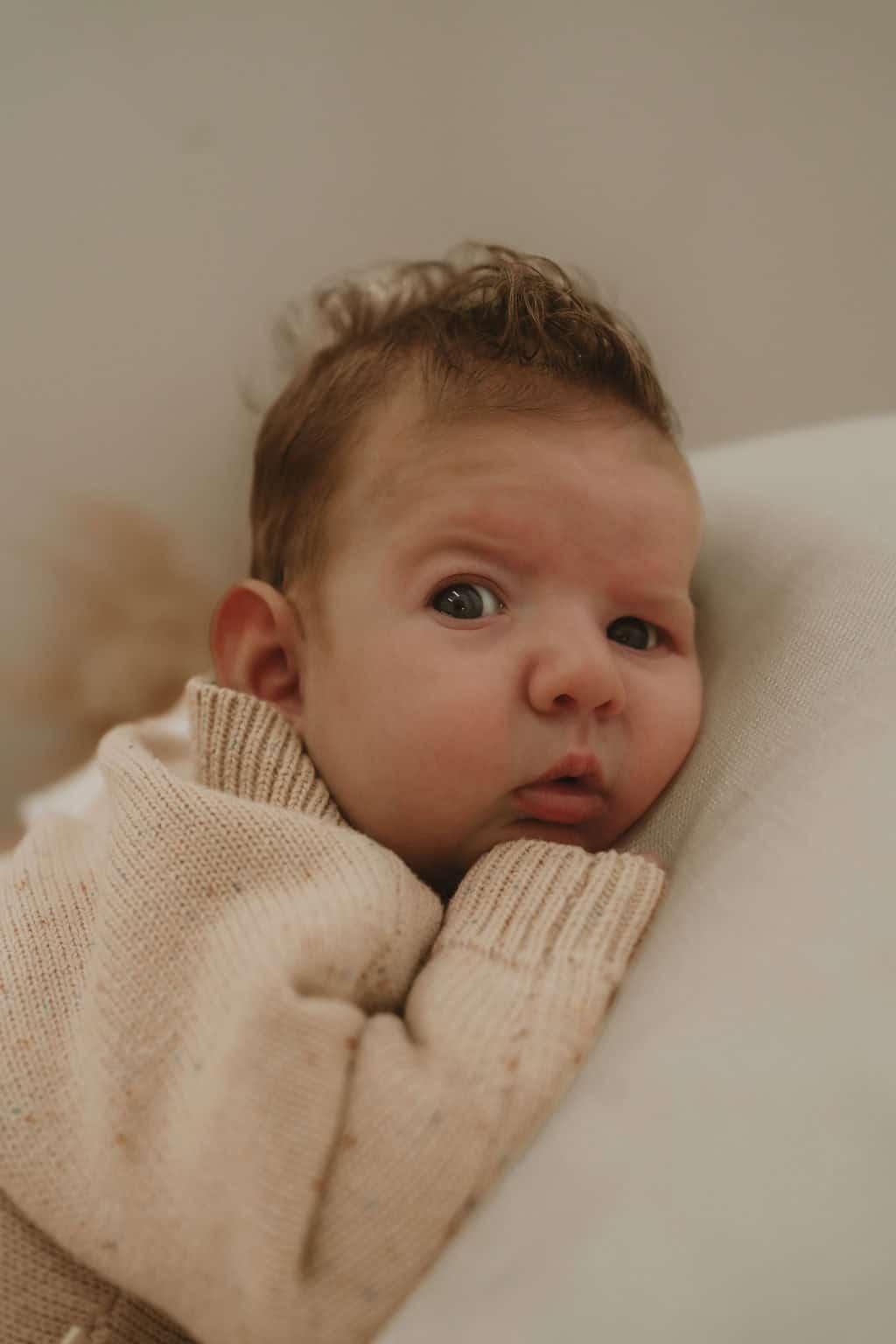 Baby boy with Hypoxic Ischemic Encephalopathy and Unicoronal synostosis