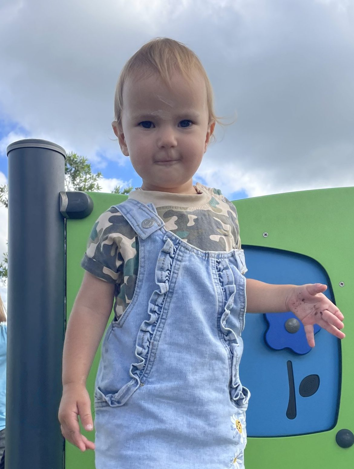 Girl with sagittal synostosis standing on a playground outdoors