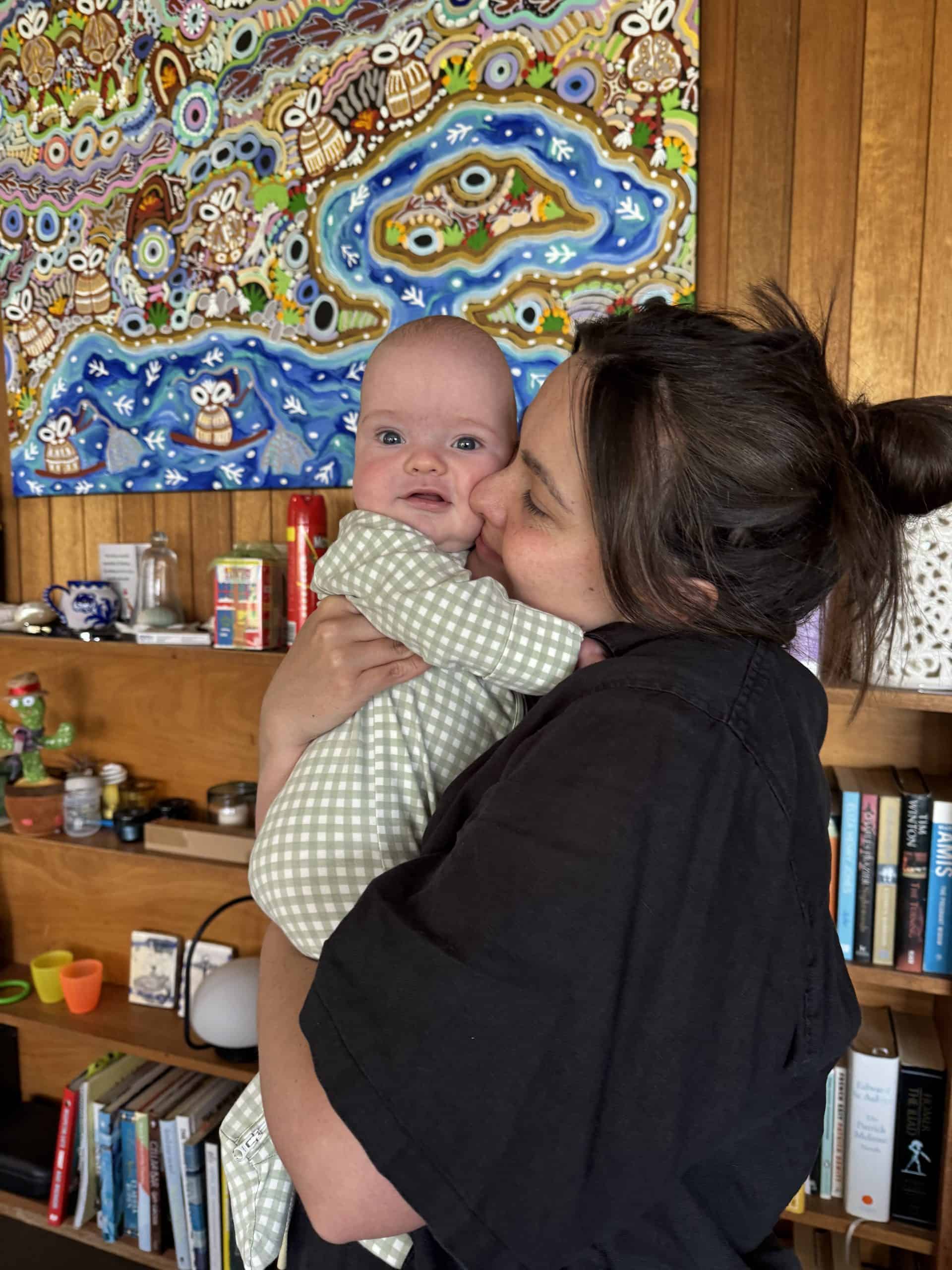 Caring mother holding baby with craniofacial condition in a home setting.