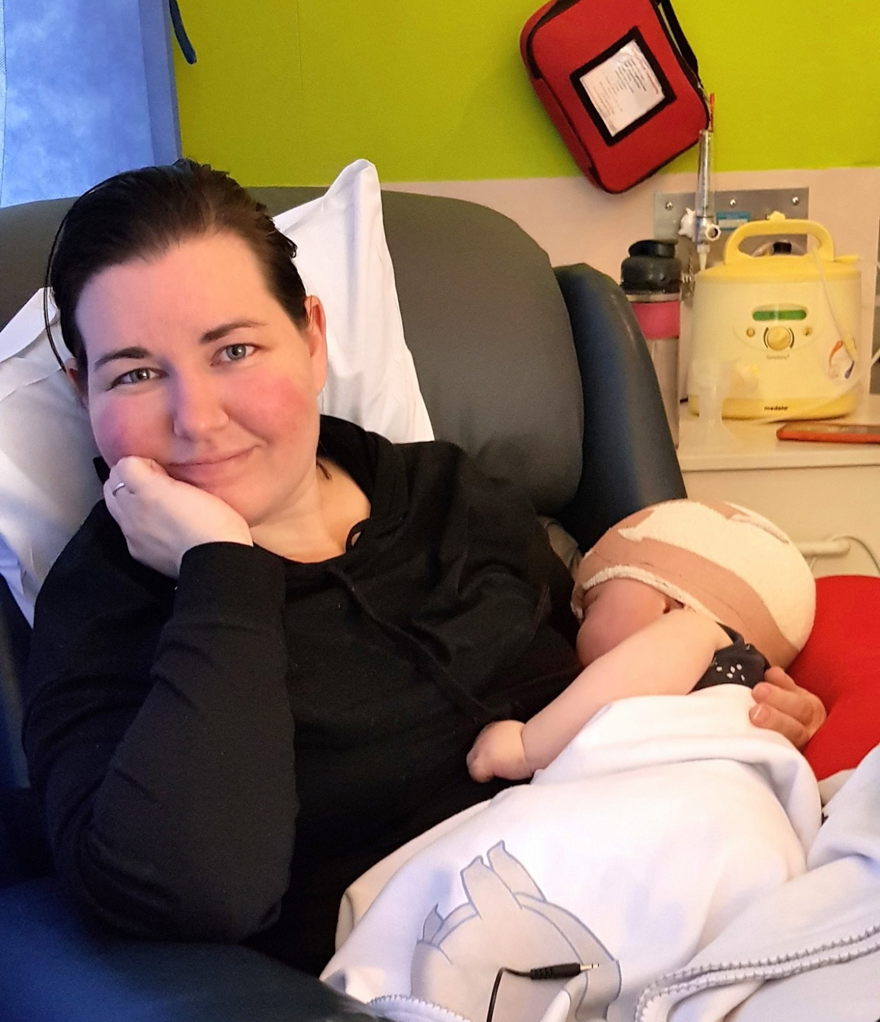 Baby with sagittal synostosis sleeping, held by his mother