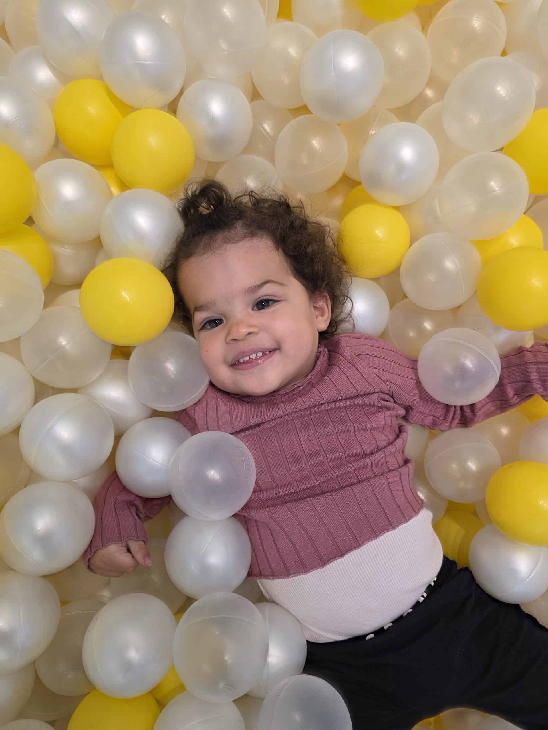 Girl with metopic synostosis after recovering from craniofacial surgery