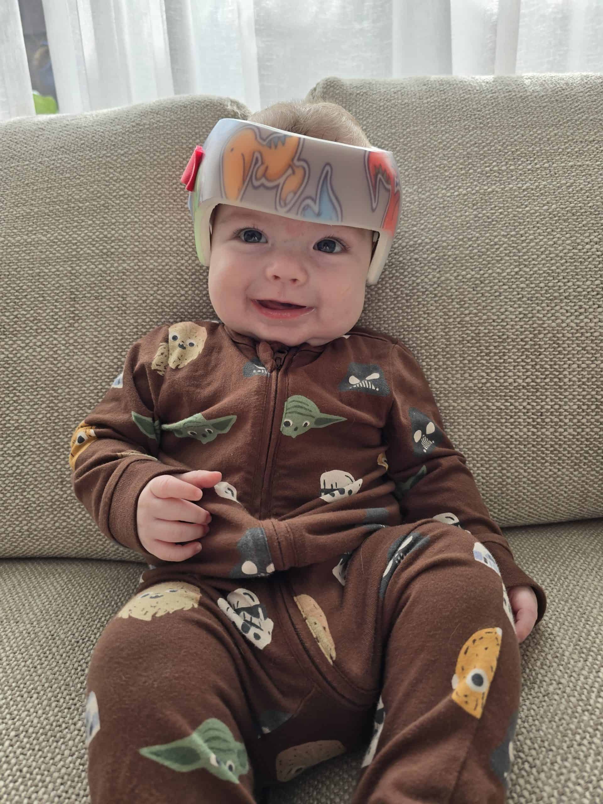 Craniofacial baby wearing a helmet, sitting on a sofa, smiling, in a medical or therapy setting.