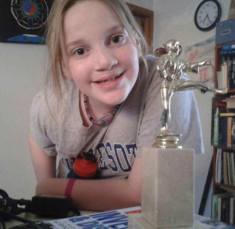 Girl with cleft lip and palate