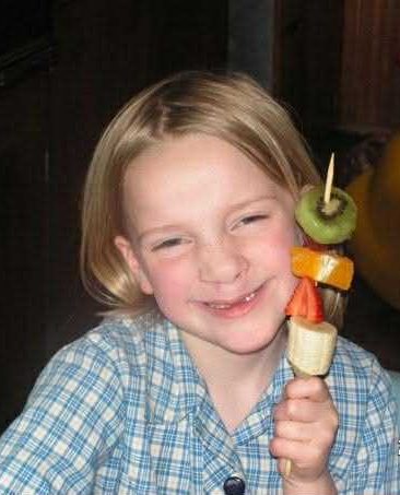 Girl with cleft lip and palate, holding a fruit skewer