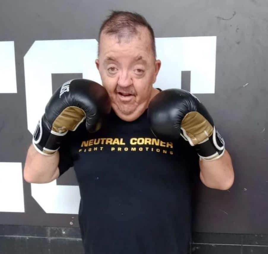 Man with Apert syndrome, wearing boxing gloves and posing for the photo