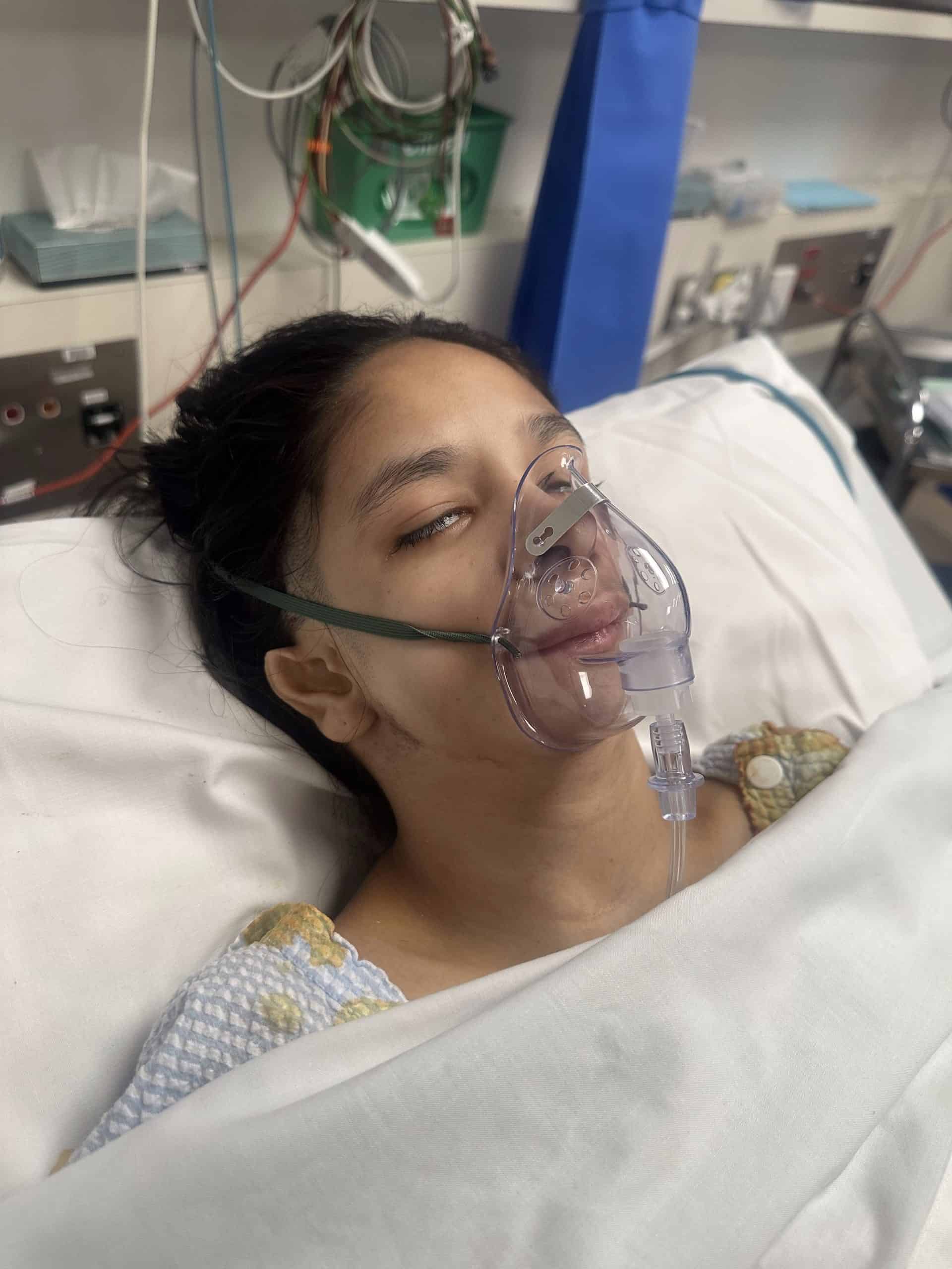 Girl with Nager Syndrome in hospital bed with oxygen mask after craniofacial surgery.