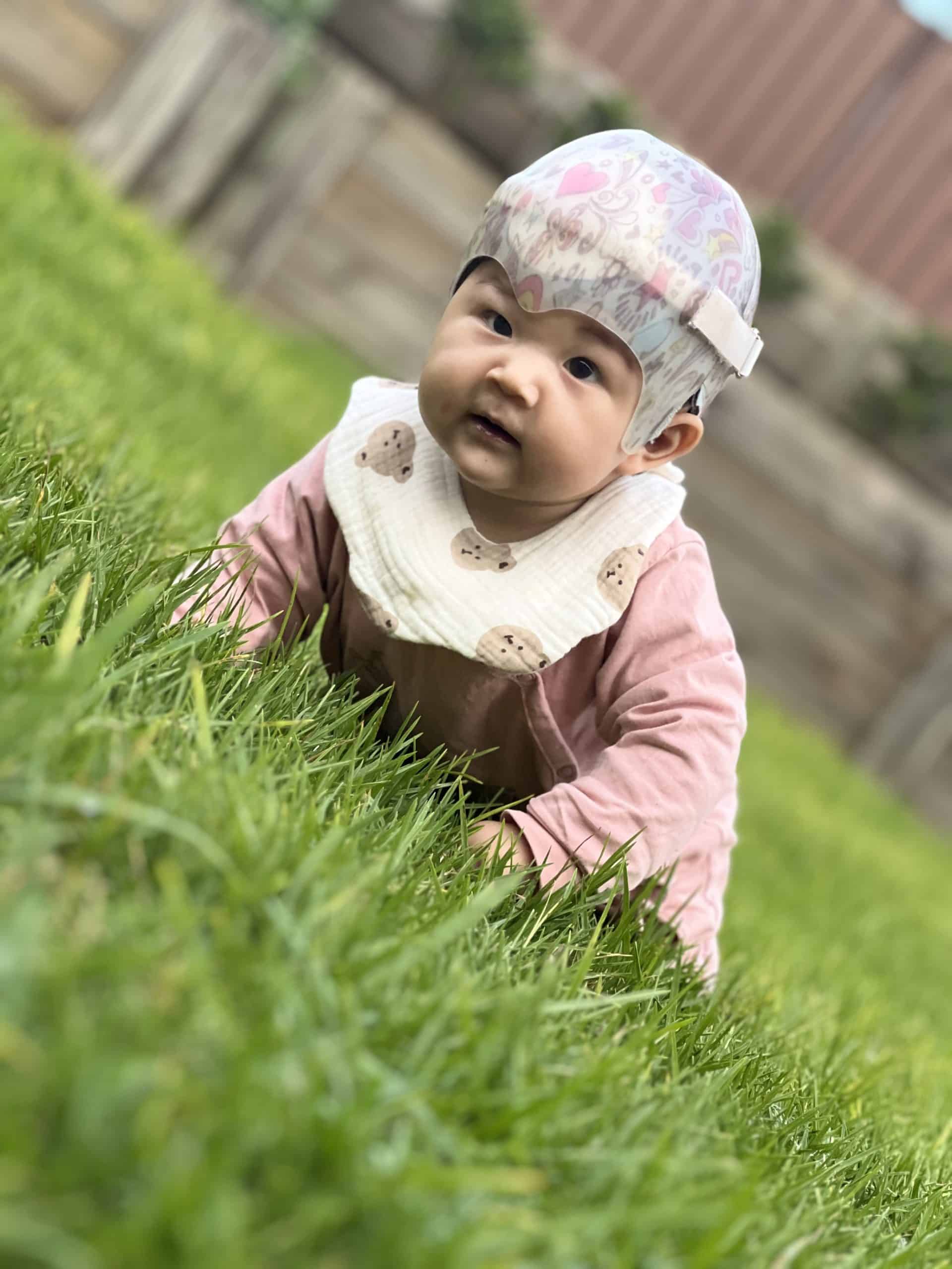 Baby wearing helmet following surgery for metopic synostosis crawling on grass outdoors.