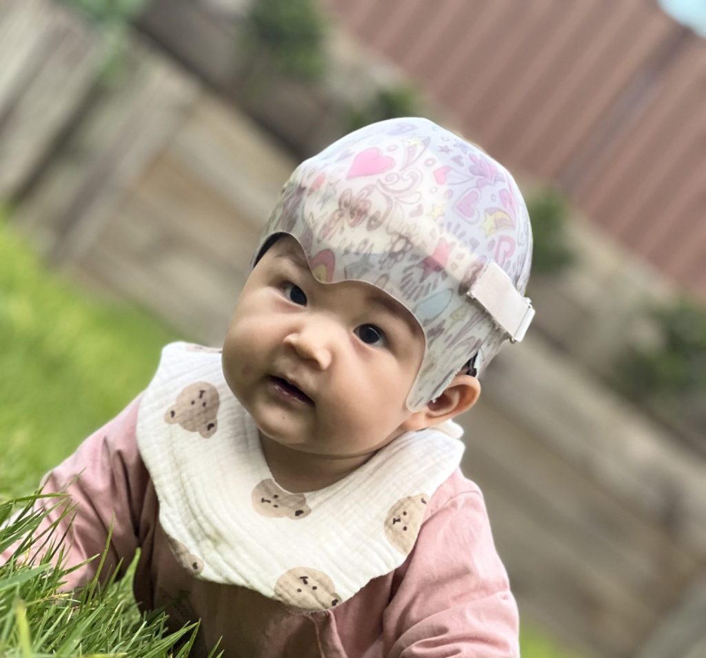 Baby wearing helmet following surgery for metopic synostosis crawling on grass outdoors.