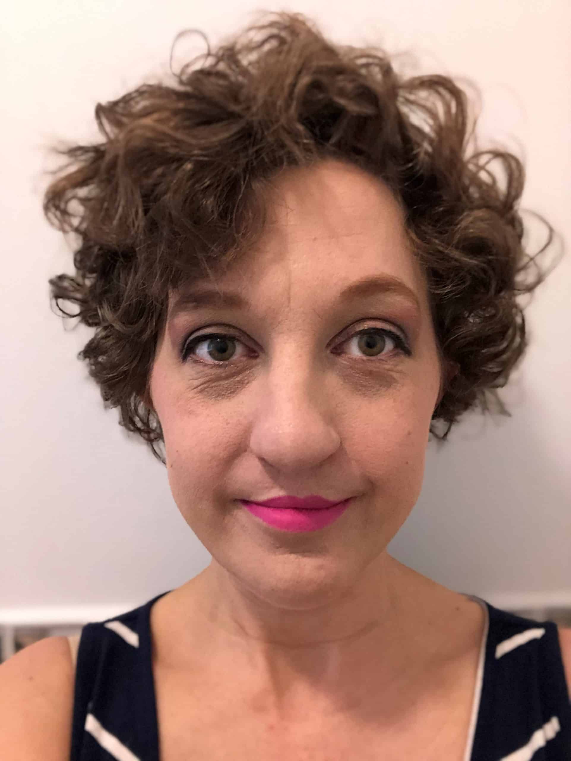 Woman who had surgery for cleft lip and palate