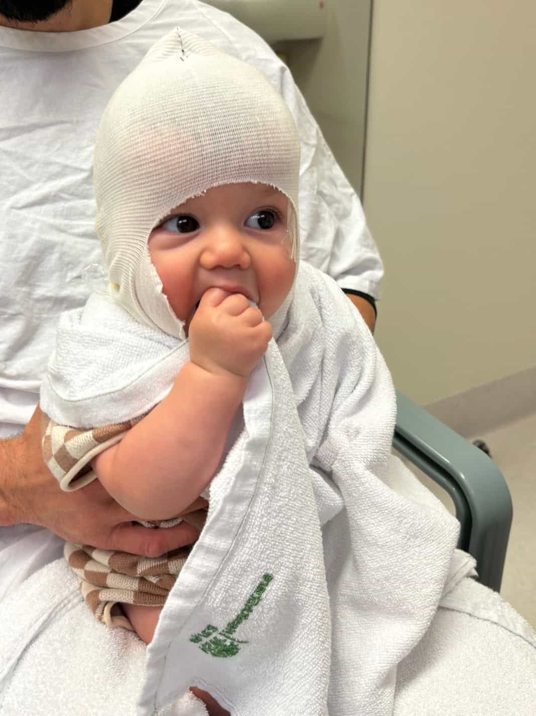 Young child with craniofacial condition in hospital gown and head bandage.
