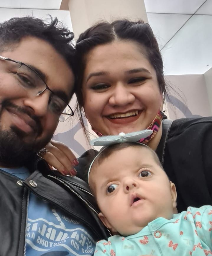 4 month old Pakistani girl with Apert syndrome with her parents