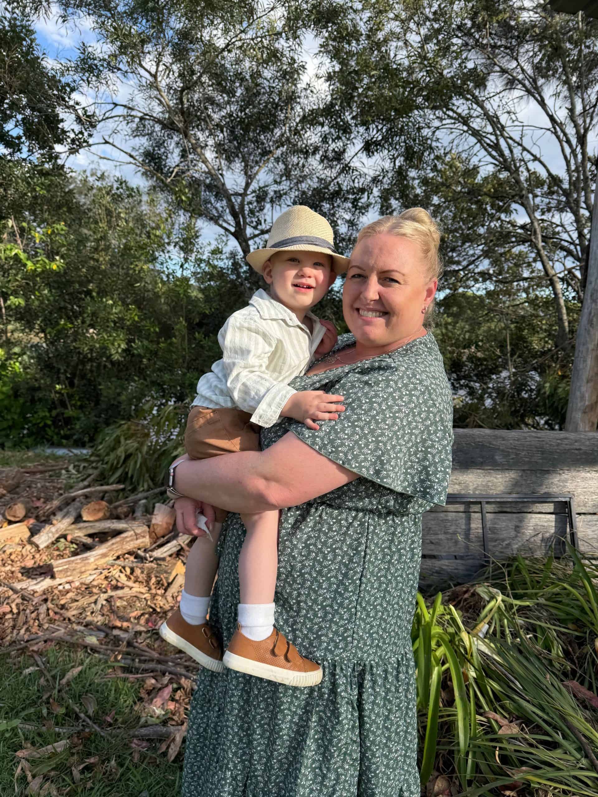 Toddler with metopic synostosis outdoors, held by his mother.