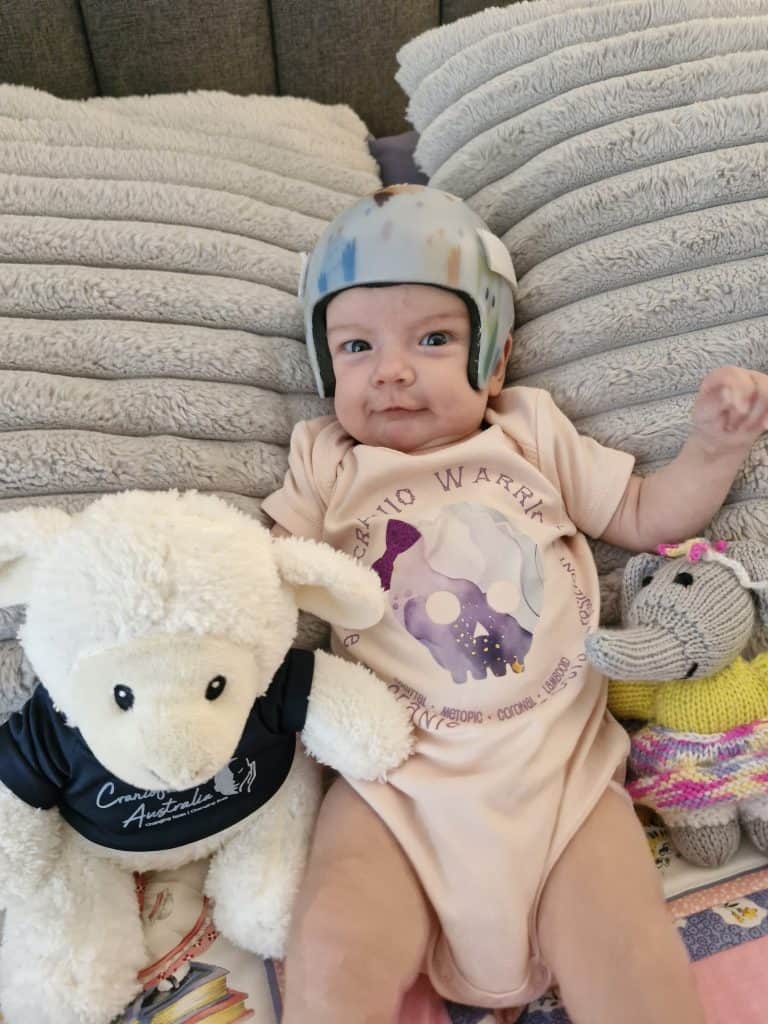 Young child with helmet lying on pillows with stuffed animals, Craniofacial Australia.