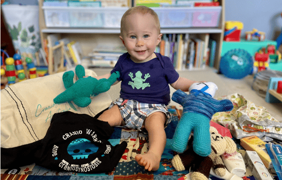 Child with toys and books in a colourful playroom at Craniofacial Australia.